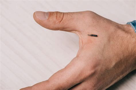 microchip implants banned